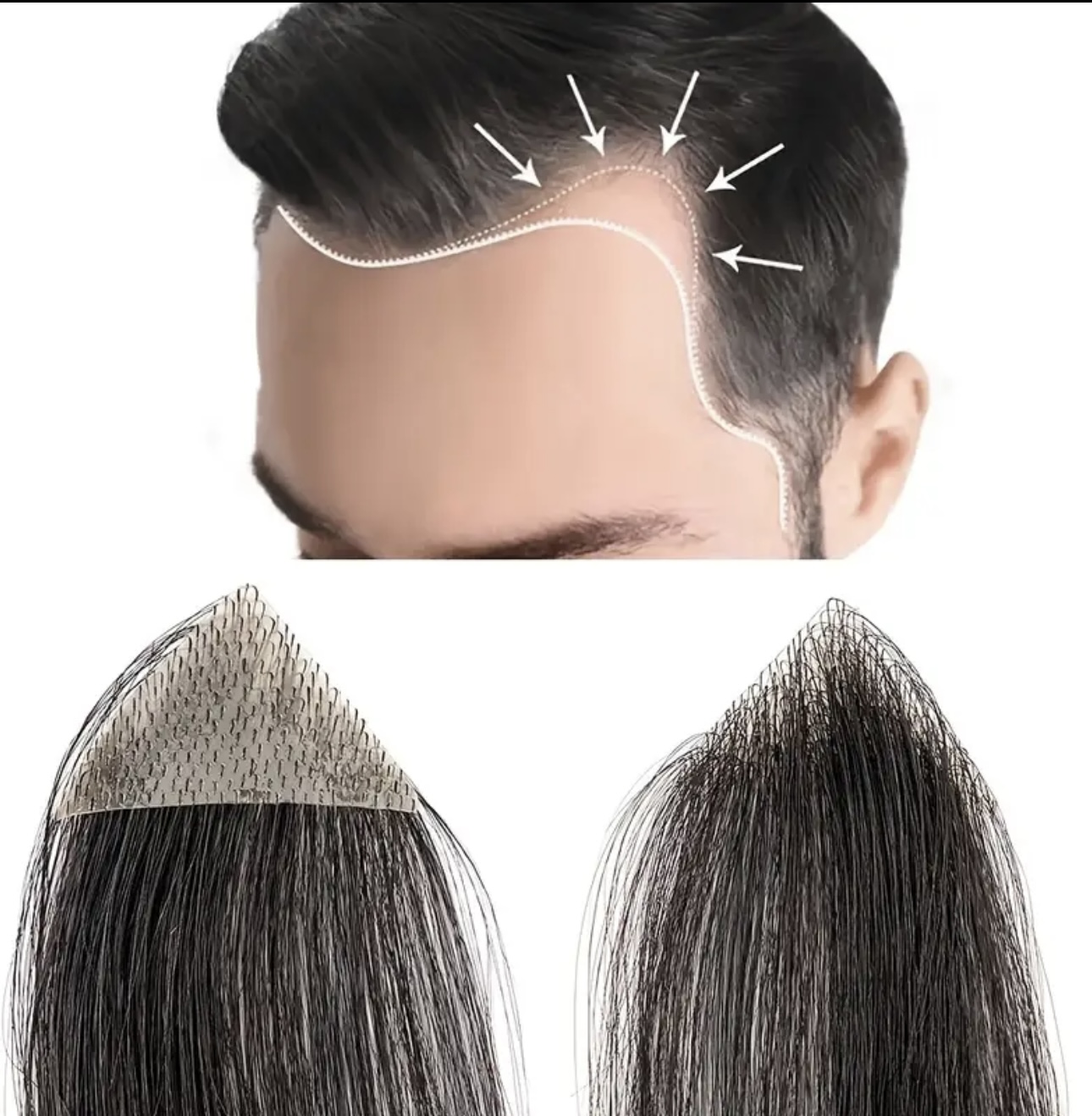 Mesa Adeziva pentru Alopecie - Extensii de par București
